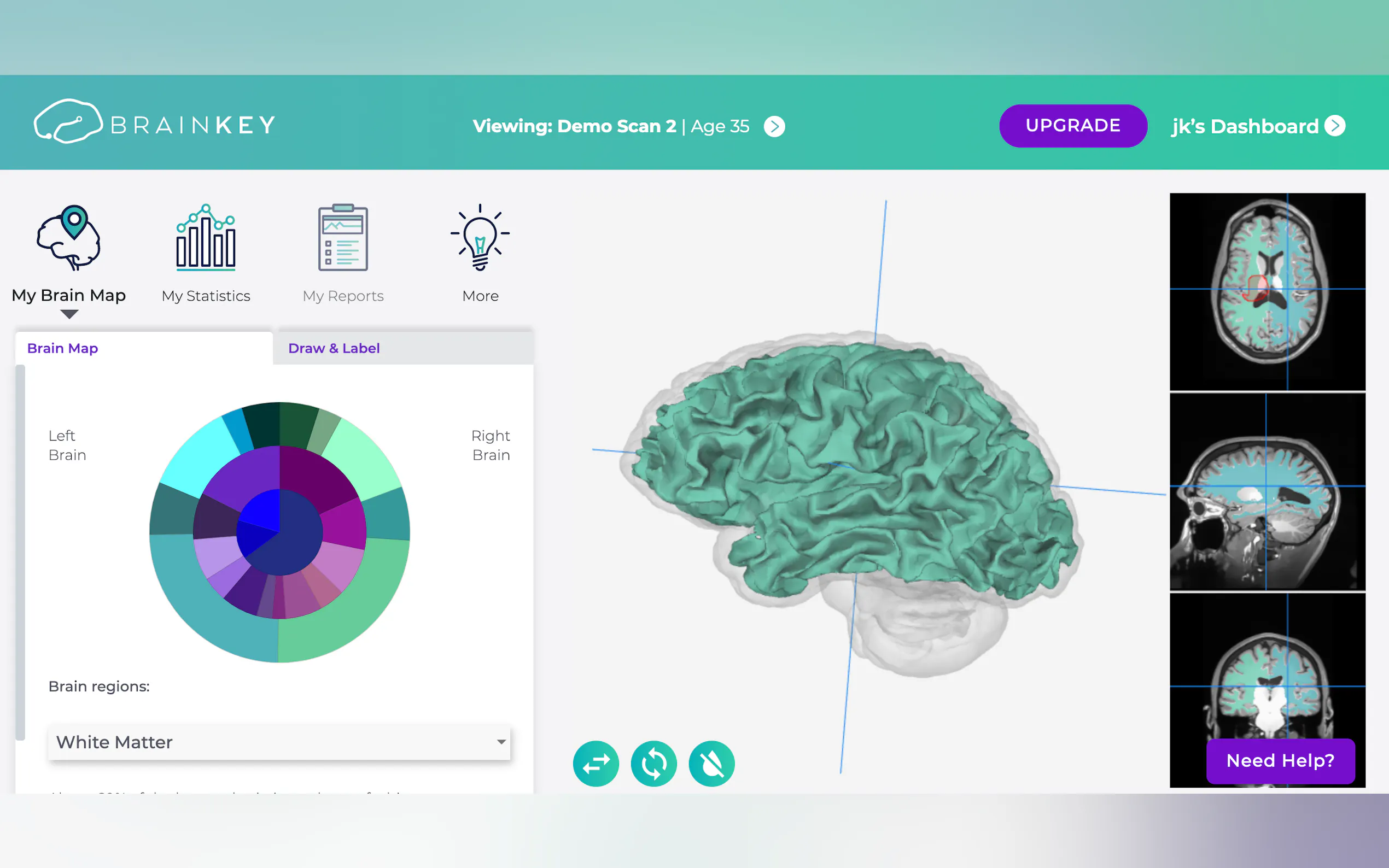 Screenshot 3 of BrainKey