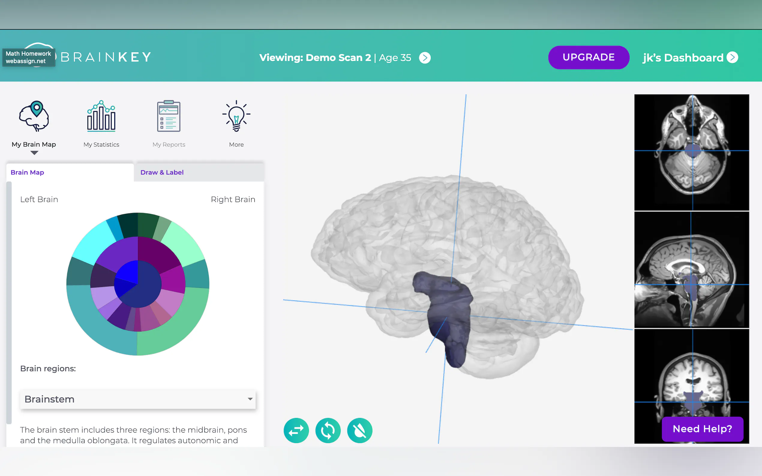 Screenshot 4 of BrainKey