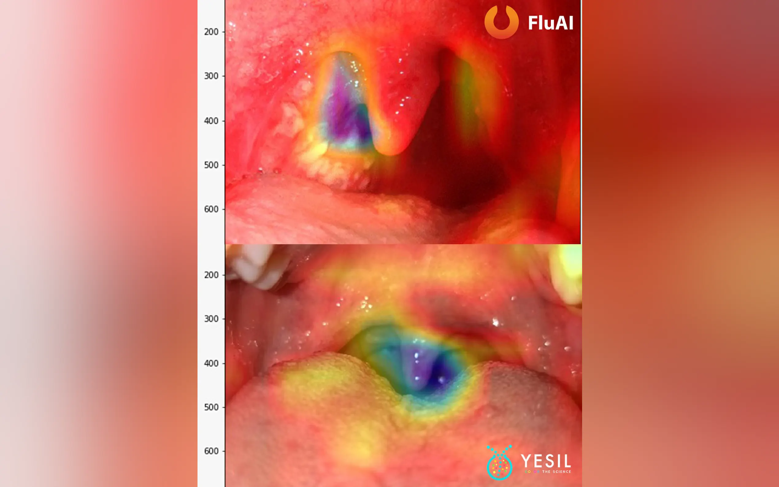 Screenshot 2 of FluAI