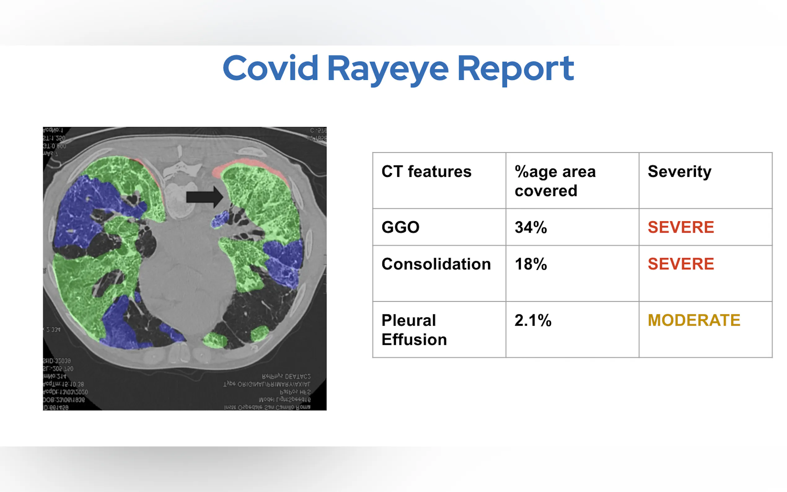 Screenshot 2 of RayEye