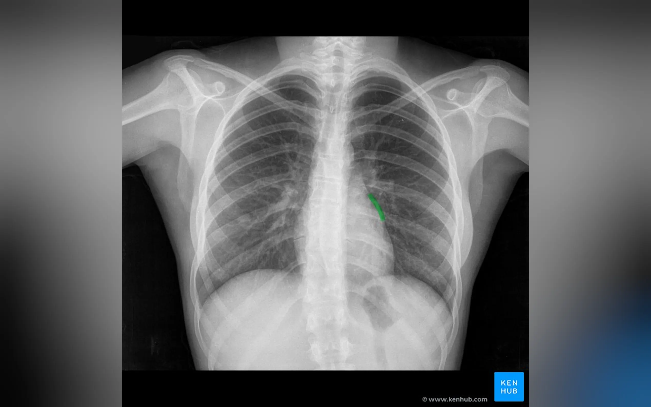 Screenshot 2 of Robodoc